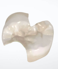 Inlay / Onlay - Cad Design