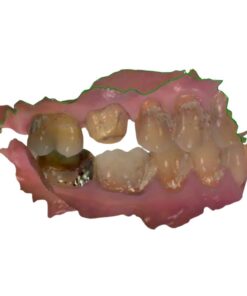 Cerec to STL file conversion service at Viet Dental Lab