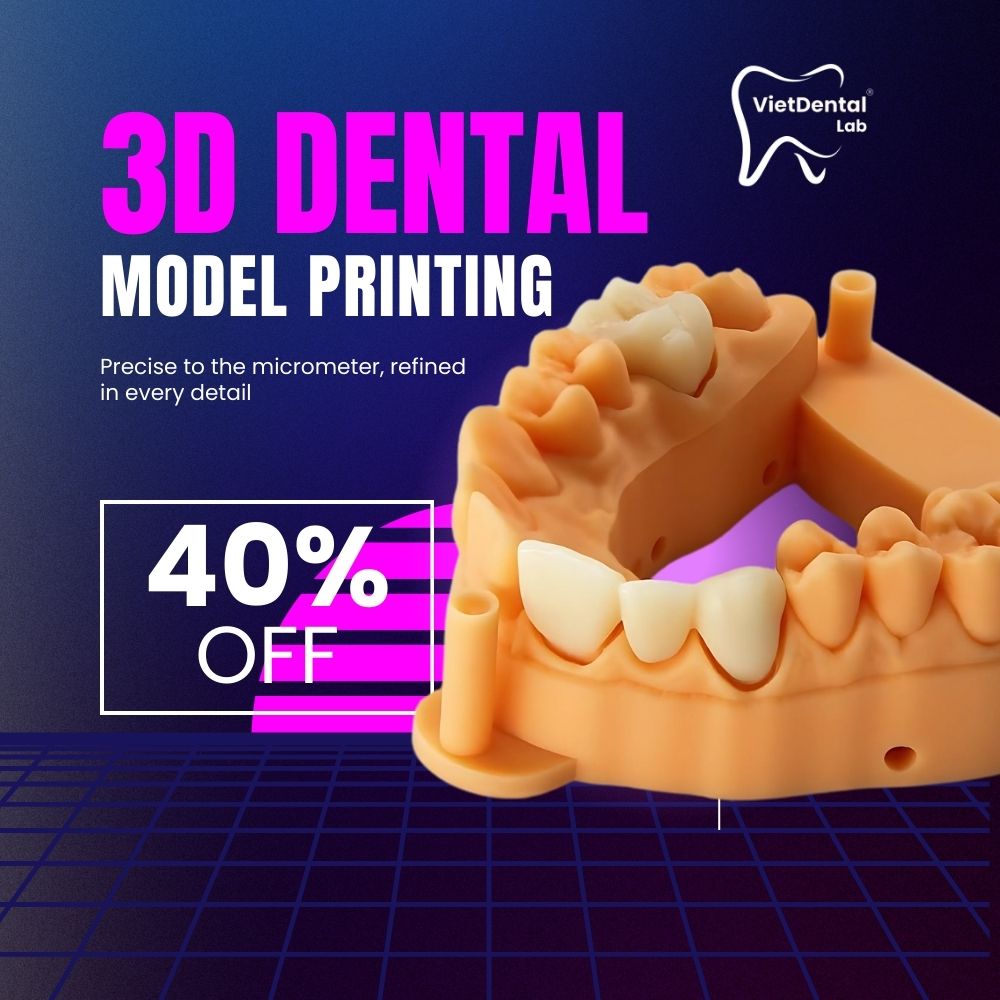 3D dental model printing service for global dentists using STL files