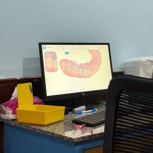 Digital impression scanning service using professional intraoral scanner at Viet Dental Lab for accurate dental models